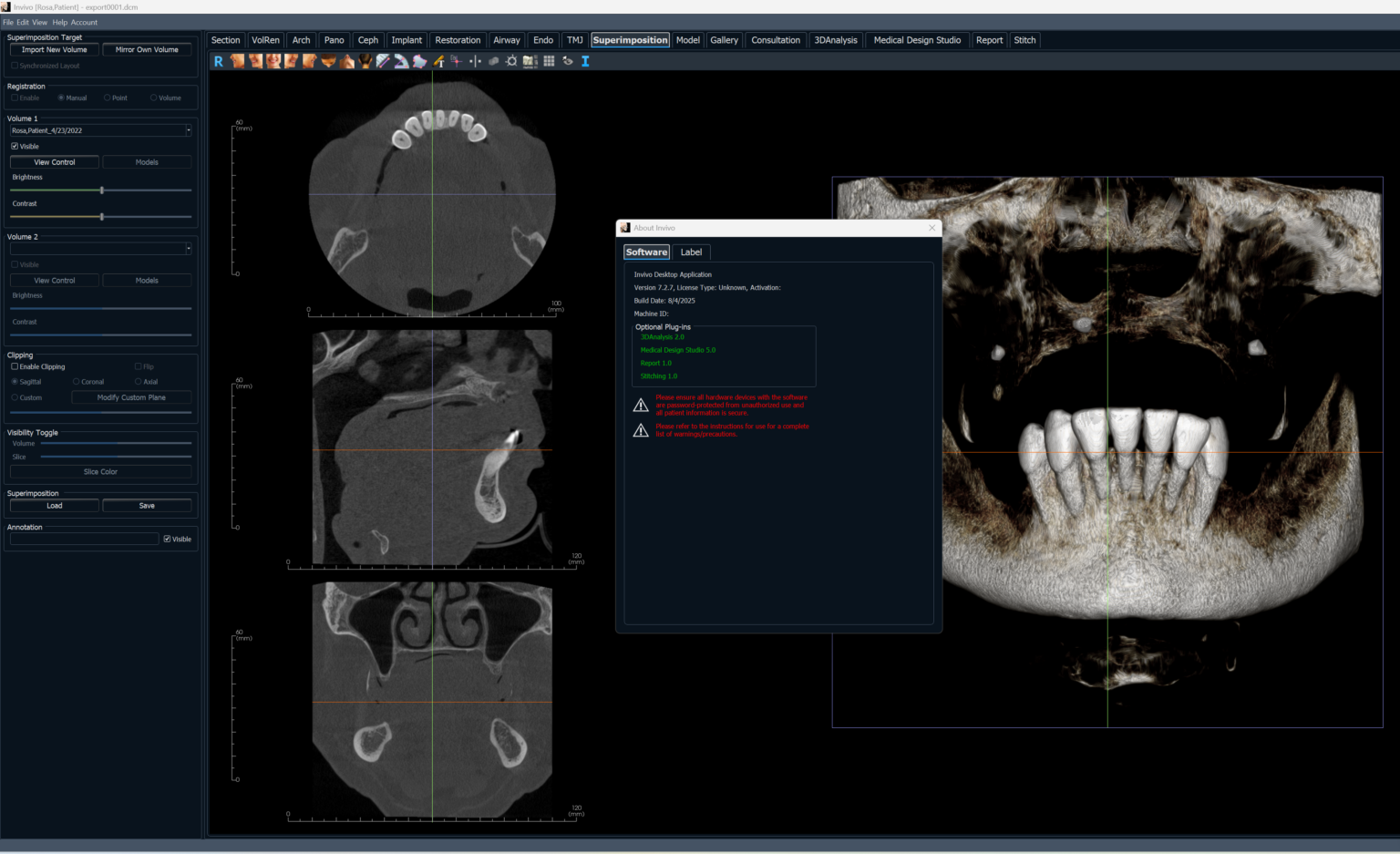 Iinvivo Dental 7.2.7 Latest Version