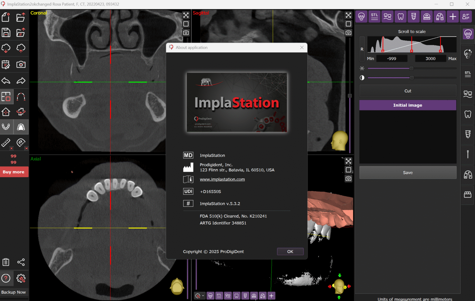 ImplaStation 5.3 Full Version Latest Update