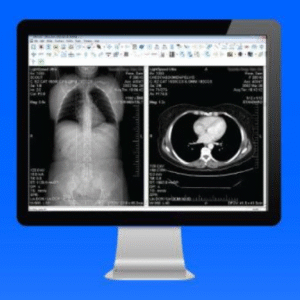 eFilm Workstation 4.3